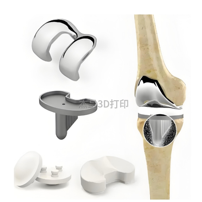 3D打印技术为医疗领域带来变革