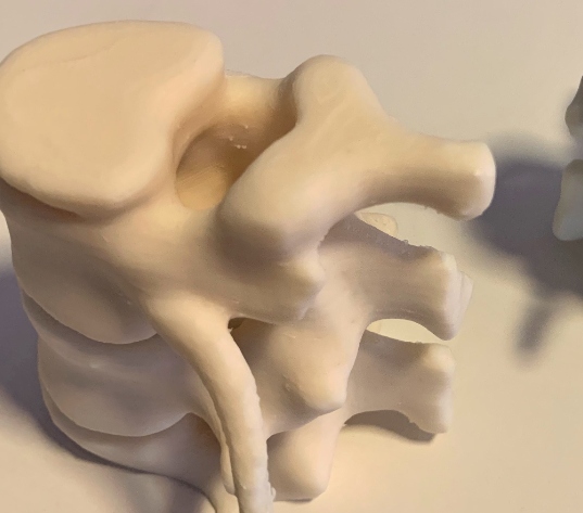 医用PEEK材料国产化实现从钛合金替代到3D打印的突破
