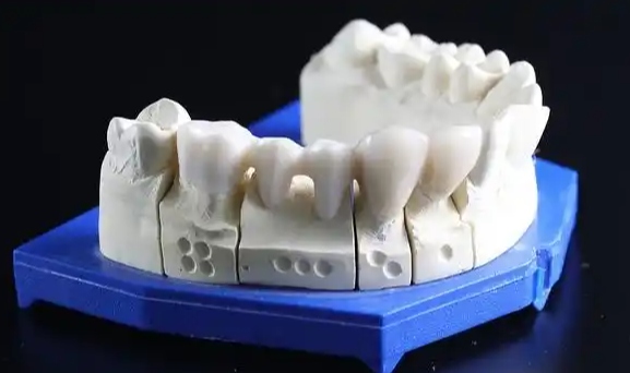 3D打印在牙科应用的市场规模怎么样？用到了哪些技术