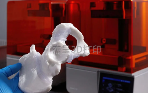3D打印面临的机遇在医疗领域能改变我们的生活吗？