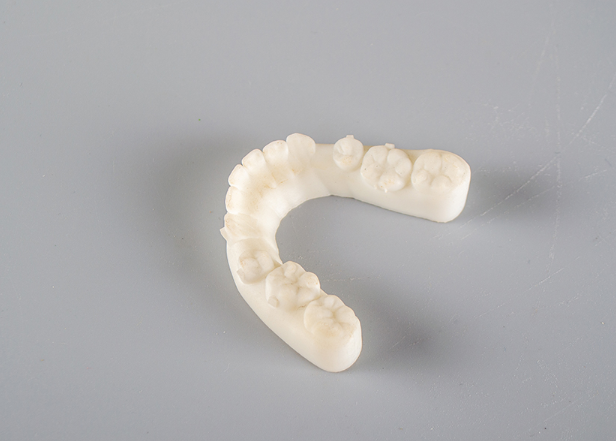 假牙能用3D打印做吗？解析数字化义齿新工艺